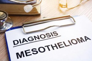 Mesothelioma Diagnosis: